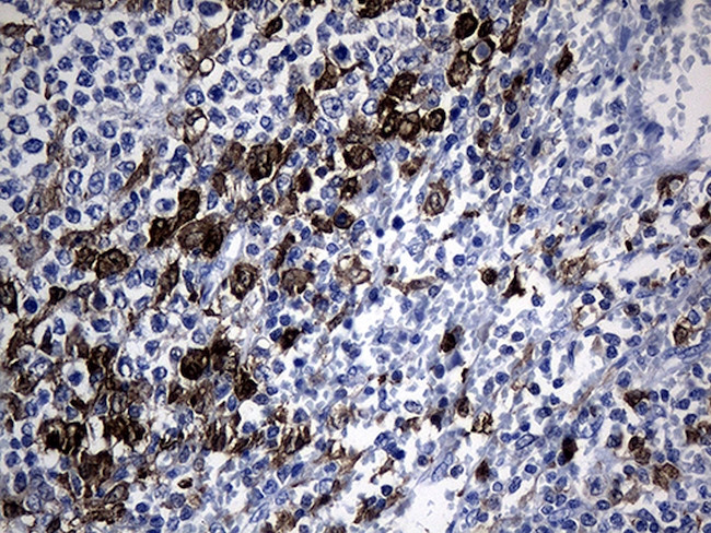 GCH1 Antibody in Immunohistochemistry (Paraffin) (IHC (P))