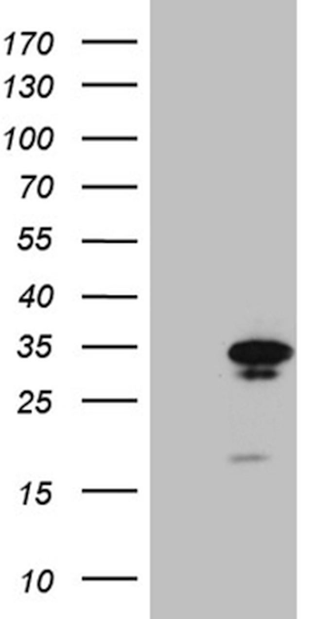 GCH1 Antibody in Western Blot (WB)