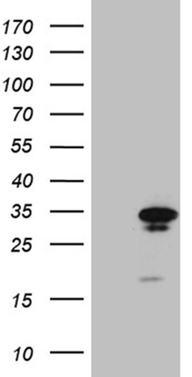 GCH1 Antibody in Western Blot (WB)