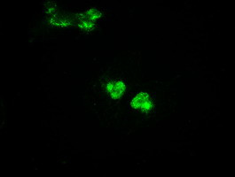 GCK Antibody in Immunocytochemistry (ICC/IF)