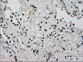 GCK Antibody in Immunohistochemistry (Paraffin) (IHC (P))