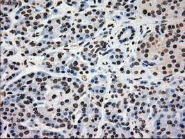 GCK Antibody in Immunohistochemistry (Paraffin) (IHC (P))