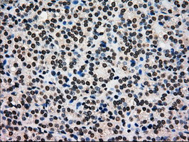 GCK Antibody in Immunohistochemistry (Paraffin) (IHC (P))