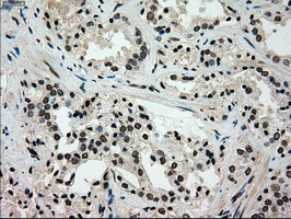 GCK Antibody in Immunohistochemistry (Paraffin) (IHC (P))