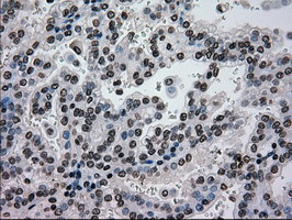 GCK Antibody in Immunohistochemistry (Paraffin) (IHC (P))