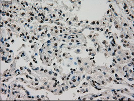 GCK Antibody in Immunohistochemistry (Paraffin) (IHC (P))