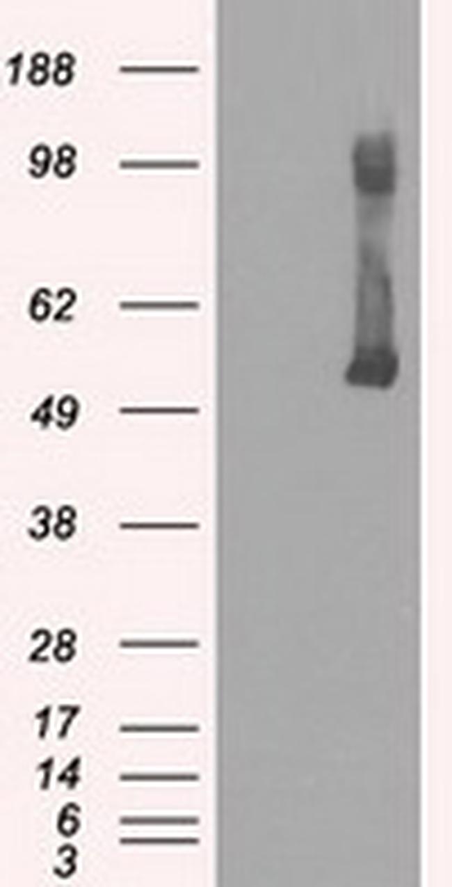 GCK Antibody in Western Blot (WB)