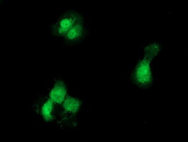 GCKR Antibody in Immunocytochemistry (ICC/IF)