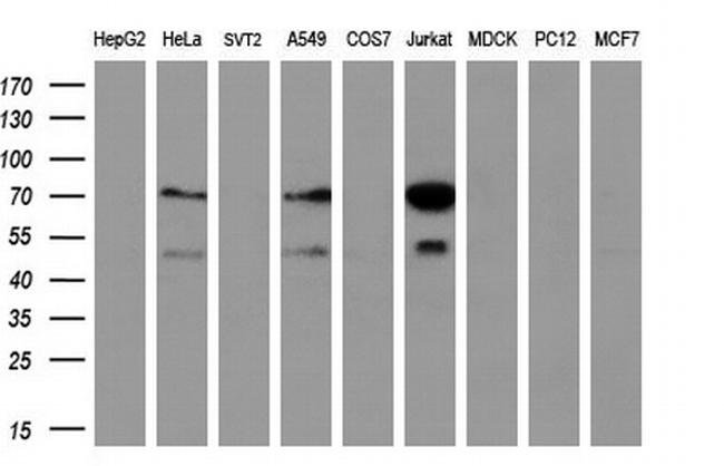 GCKR Antibody in Western Blot (WB)