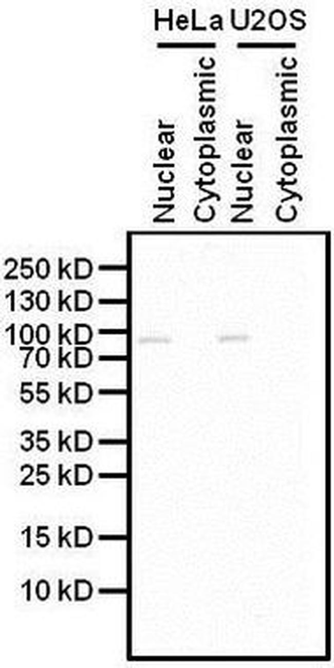 GCN5 Antibody in Western Blot (WB)