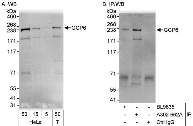 GCP6 Antibody in Western Blot (WB)