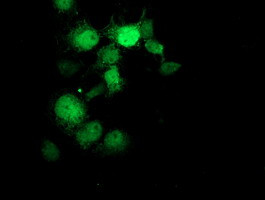 GDAP1L1 Antibody in Immunocytochemistry (ICC/IF)