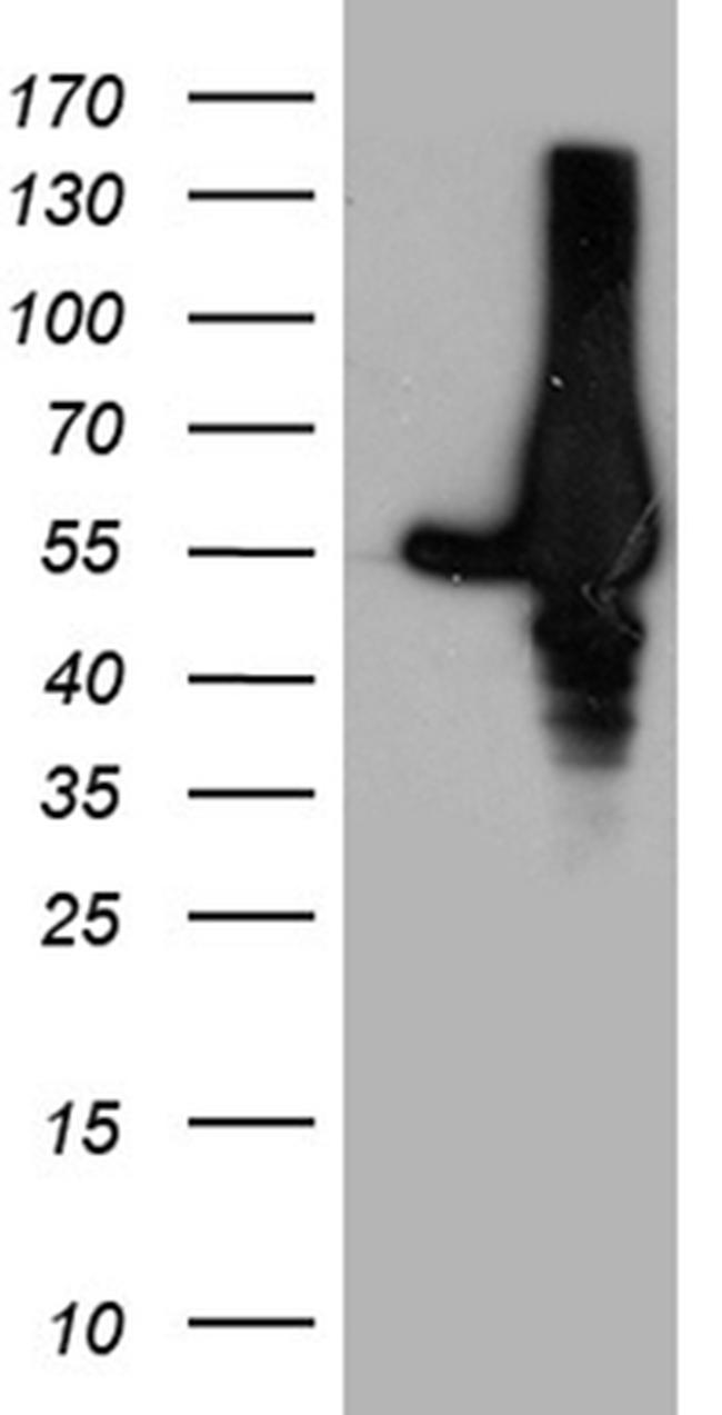 GDI1 Antibody in Western Blot (WB)