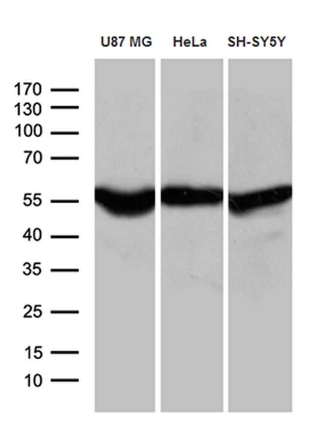 GDI1 Antibody in Western Blot (WB)