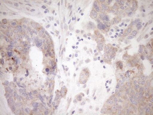 GEMIN8 Antibody in Immunohistochemistry (Paraffin) (IHC (P))