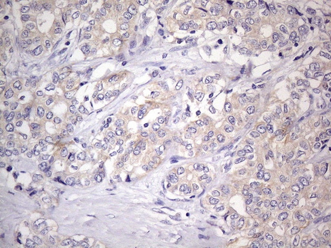 GEMIN8 Antibody in Immunohistochemistry (Paraffin) (IHC (P))