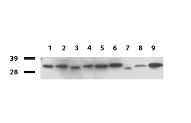 GEMIN8 Antibody in Western Blot (WB)