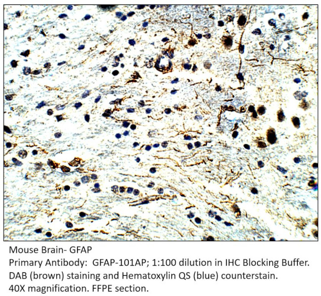 GFAP Antibody in Immunohistochemistry (IHC)