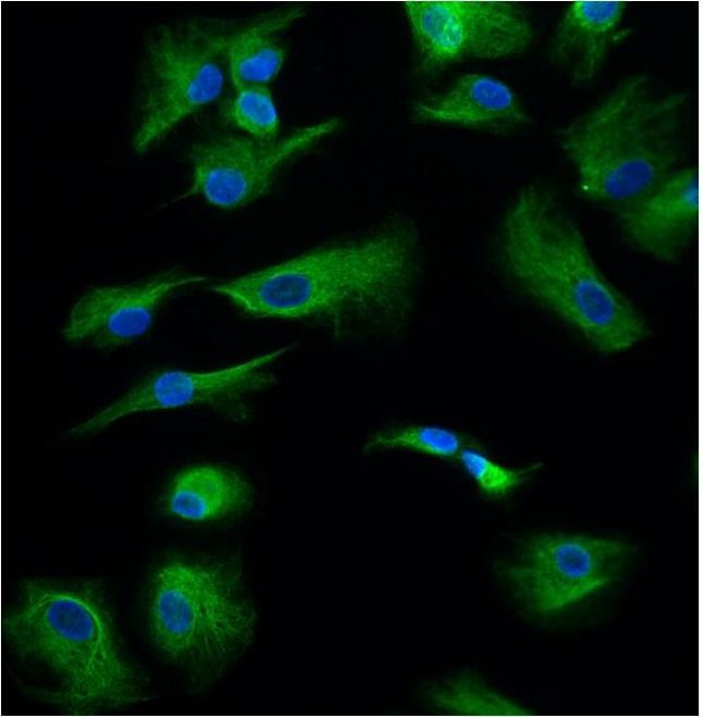 GFAP Antibody in Immunocytochemistry (ICC/IF)