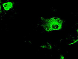 GFAP Antibody in Immunocytochemistry (ICC/IF)