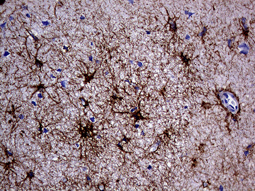 GFAP Antibody in Immunohistochemistry (Paraffin) (IHC (P))