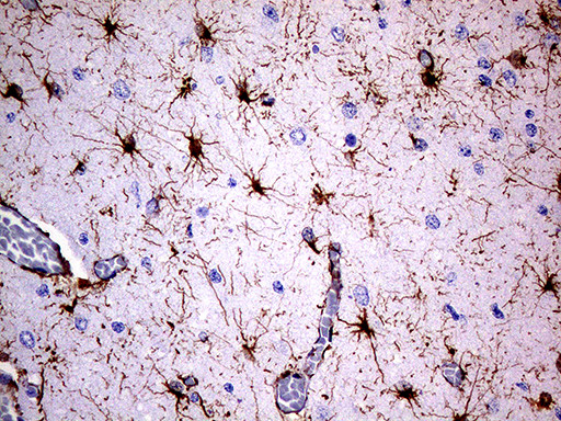 GFAP Antibody in Immunohistochemistry (Paraffin) (IHC (P))