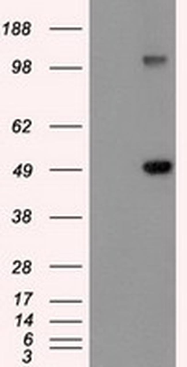 GFAP Antibody in Western Blot (WB)