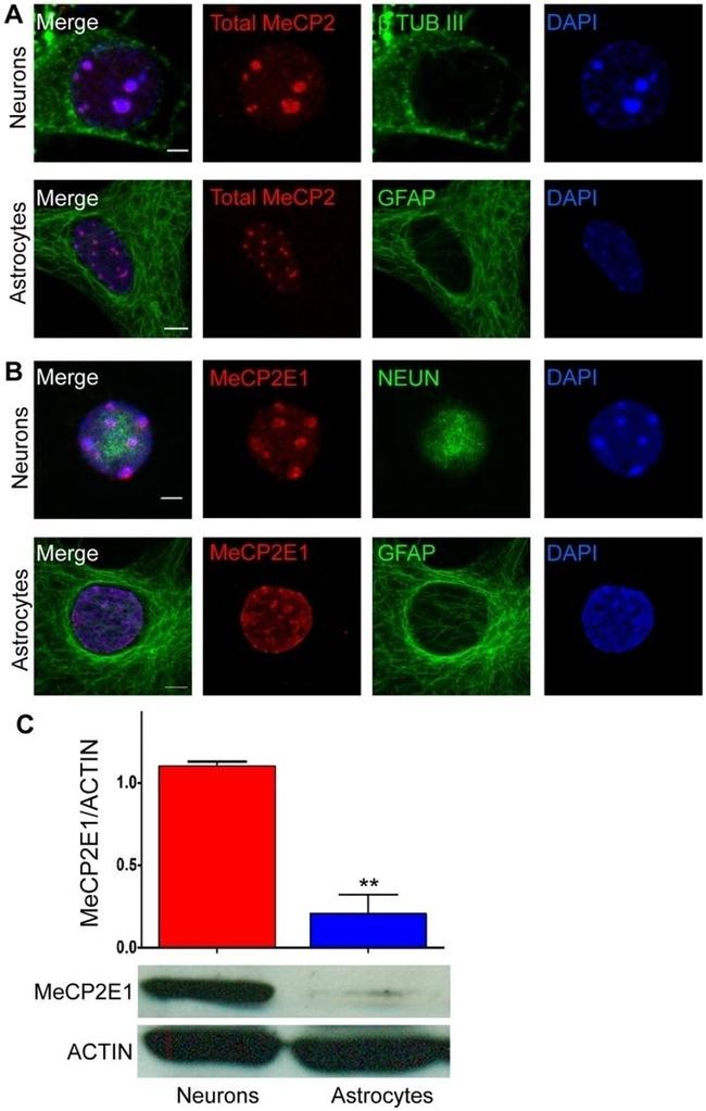 GFAP Antibody in Immunocytochemistry (ICC/IF)