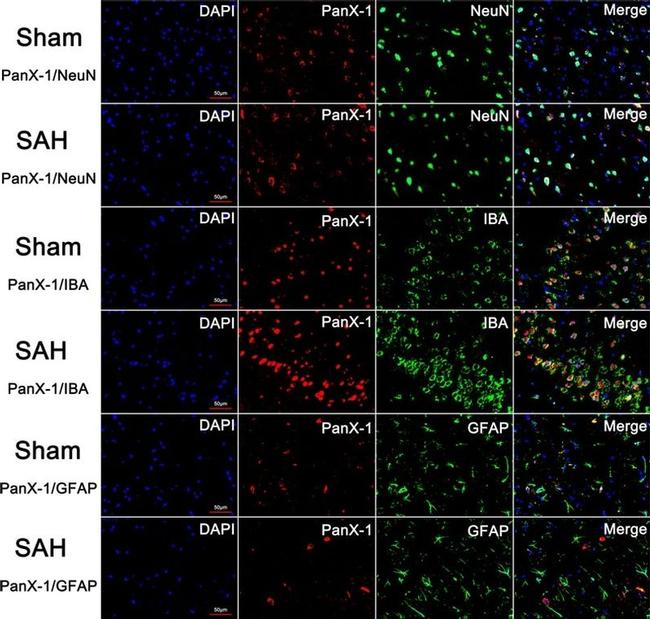 GFAP Antibody in Immunohistochemistry (IHC)