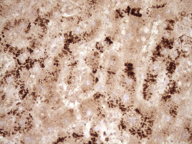 GFI1 Antibody in Immunohistochemistry (Paraffin) (IHC (P))