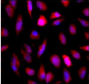 GFP Antibody in Immunocytochemistry (ICC/IF)