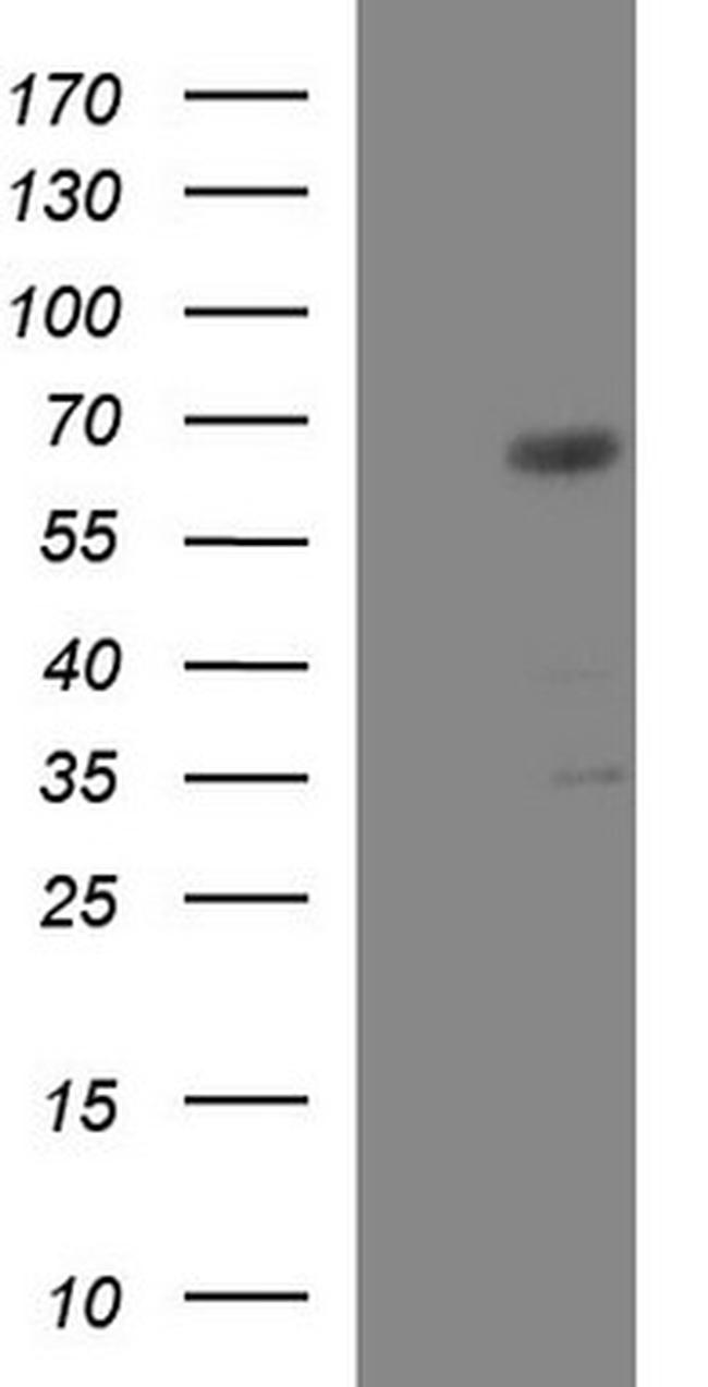 GGA2 Antibody in Western Blot (WB)