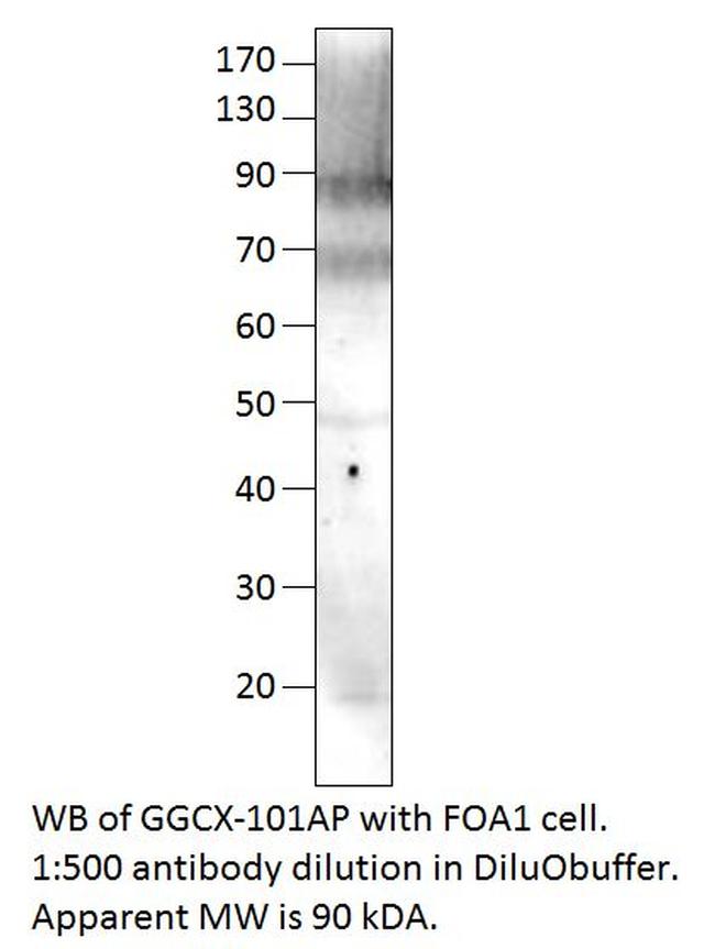 GGCX Antibody in Western Blot (WB)