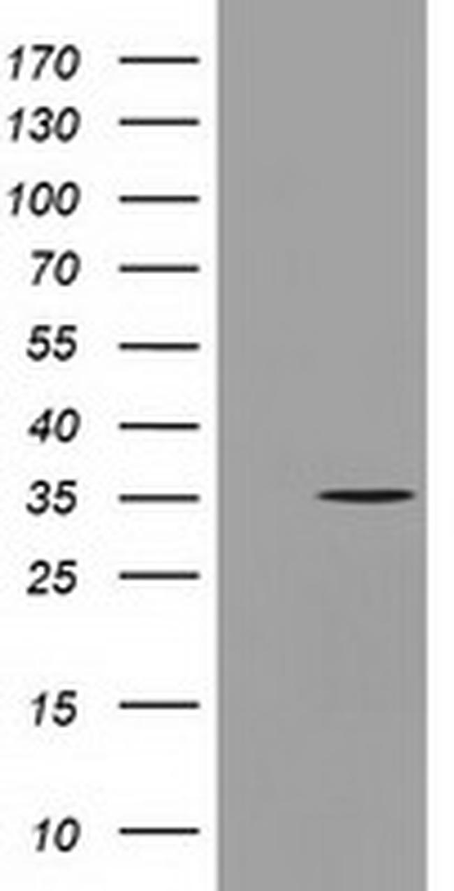 GGPS1 Antibody in Western Blot (WB)