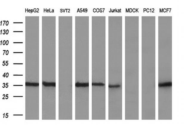 GGPS1 Antibody in Western Blot (WB)