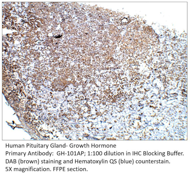 Growth Hormone Antibody in Immunohistochemistry (IHC)