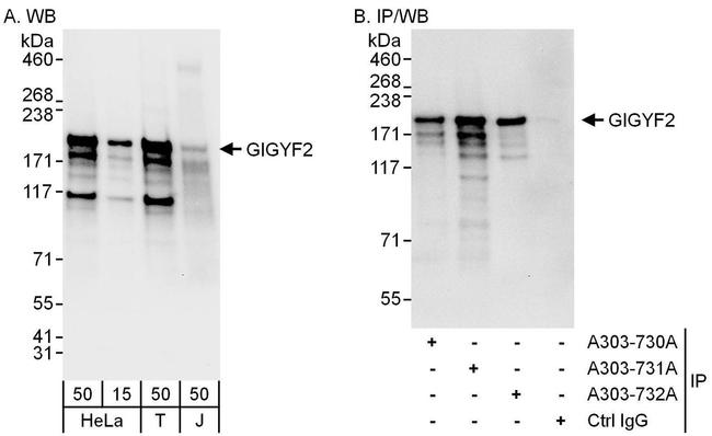 GIGYF2 Antibody in Western Blot (WB)