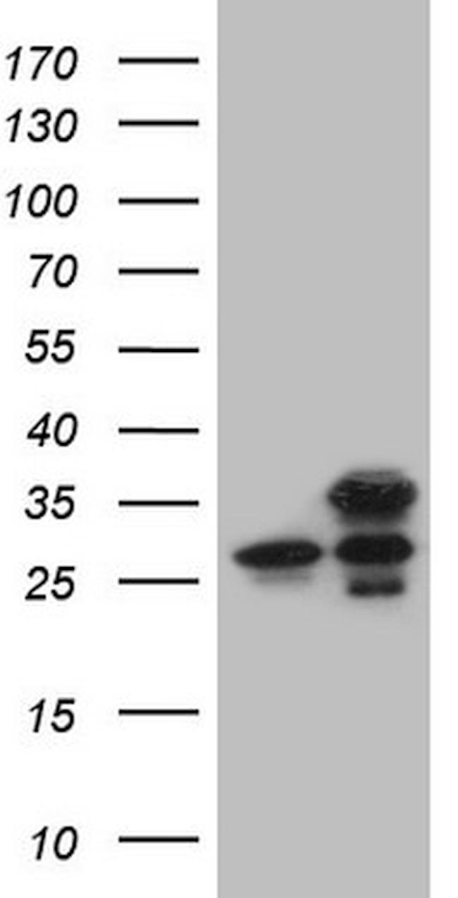 GINS3 Antibody in Western Blot (WB)