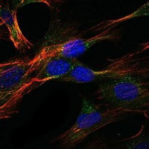 SAPAP1 Antibody in Immunocytochemistry (ICC/IF)