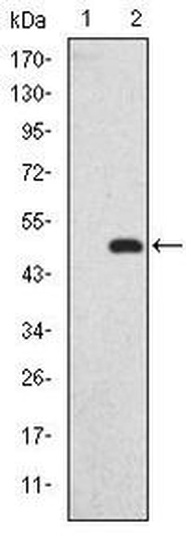 SAPAP1 Antibody in Western Blot (WB)