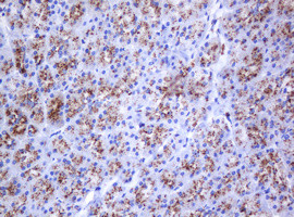 GLB1 Antibody in Immunohistochemistry (Paraffin) (IHC (P))