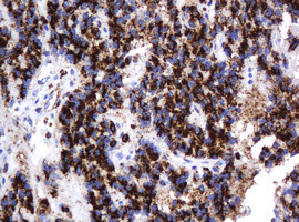 GLB1 Antibody in Immunohistochemistry (Paraffin) (IHC (P))