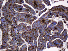 GLB1 Antibody in Immunohistochemistry (Paraffin) (IHC (P))