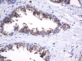 GLB1 Antibody in Immunohistochemistry (Paraffin) (IHC (P))