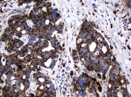 GLB1 Antibody in Immunohistochemistry (Paraffin) (IHC (P))