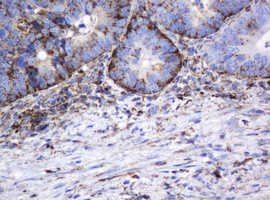 GLB1 Antibody in Immunohistochemistry (Paraffin) (IHC (P))