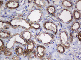 GLB1 Antibody in Immunohistochemistry (Paraffin) (IHC (P))