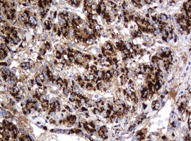 GLB1 Antibody in Immunohistochemistry (Paraffin) (IHC (P))