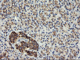 GLB1 Antibody in Immunohistochemistry (Paraffin) (IHC (P))