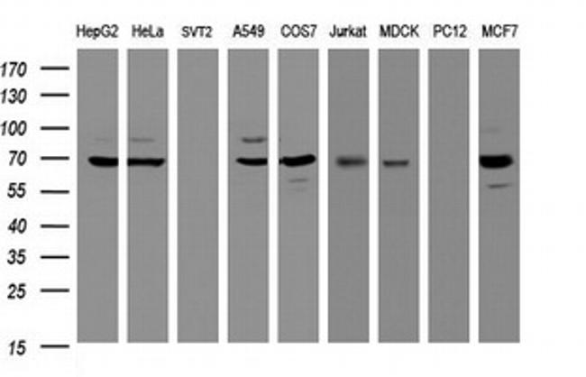 GLB1 Antibody in Western Blot (WB)